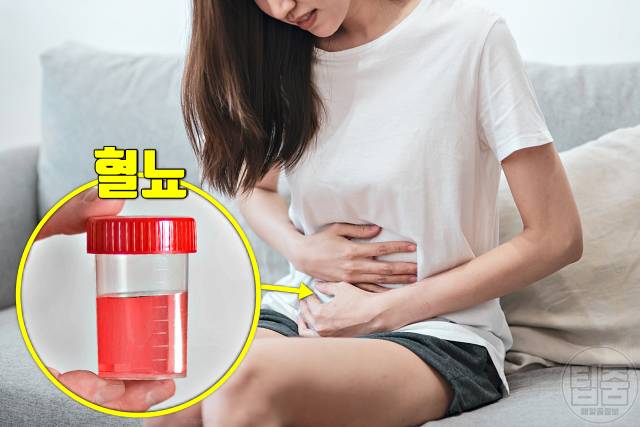 과로증상 피곤하면 혈뇨 쌍커풀 입술물집 귀가멍멍 코피 코골이 두드러기