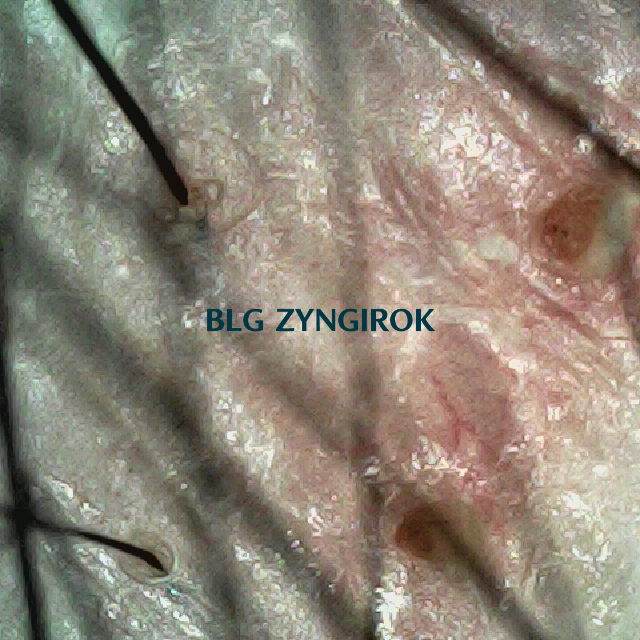 피나모아 복용 15주차 두피 사진 - 정수리와 이마 사이 붉은 부위 모습이다.