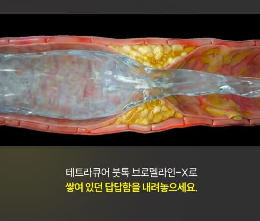 붓톡 브로멜라인 효능