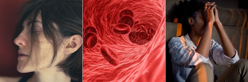 재생불량성 빈혈 생존율