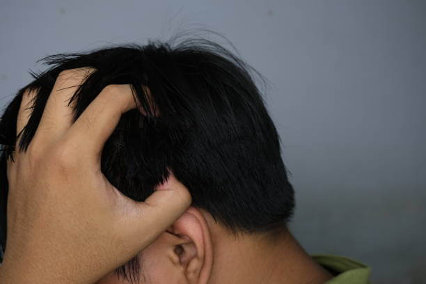 지루성 두피염의 피부 생리학적 메커니즘