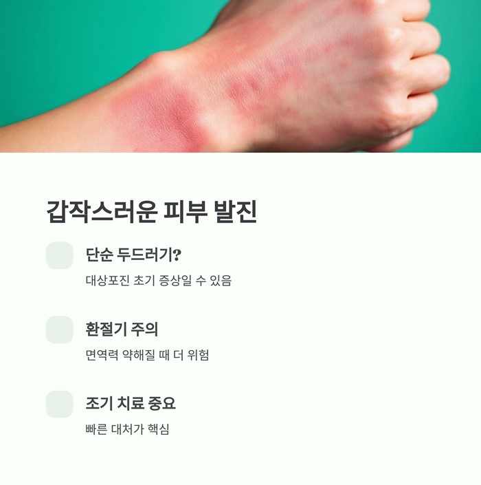 대상포진 초기증상 5가지&amp;#44; 단순 두드러기와 다른 점 요약 이미지