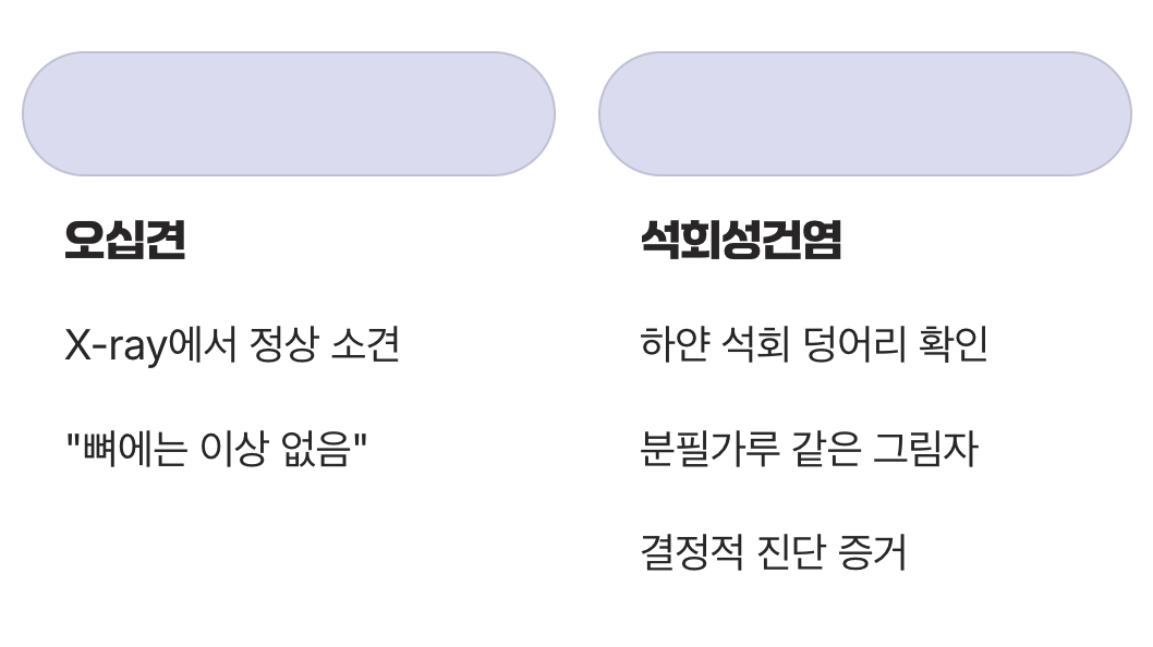 차이점 3: X-ray에 나타나는 '결정적 증거'