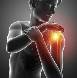 고관절 통증 증상 원인 치료법 스트레칭 운동 총정리