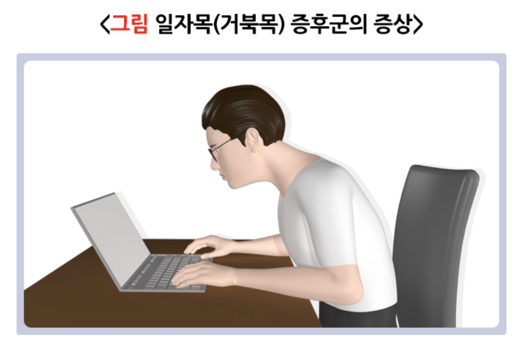 거북목 증후군의 증상