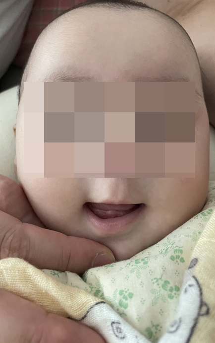 첫니가 나기 시작한 6개월 아기