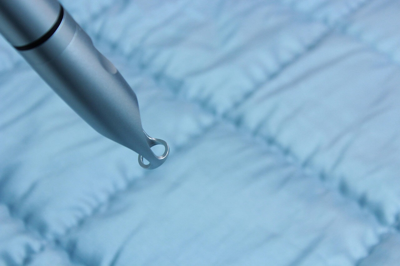 봄맞이 피부과 색소레이저 편