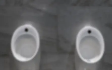 과민성 대장증후군 증상 36