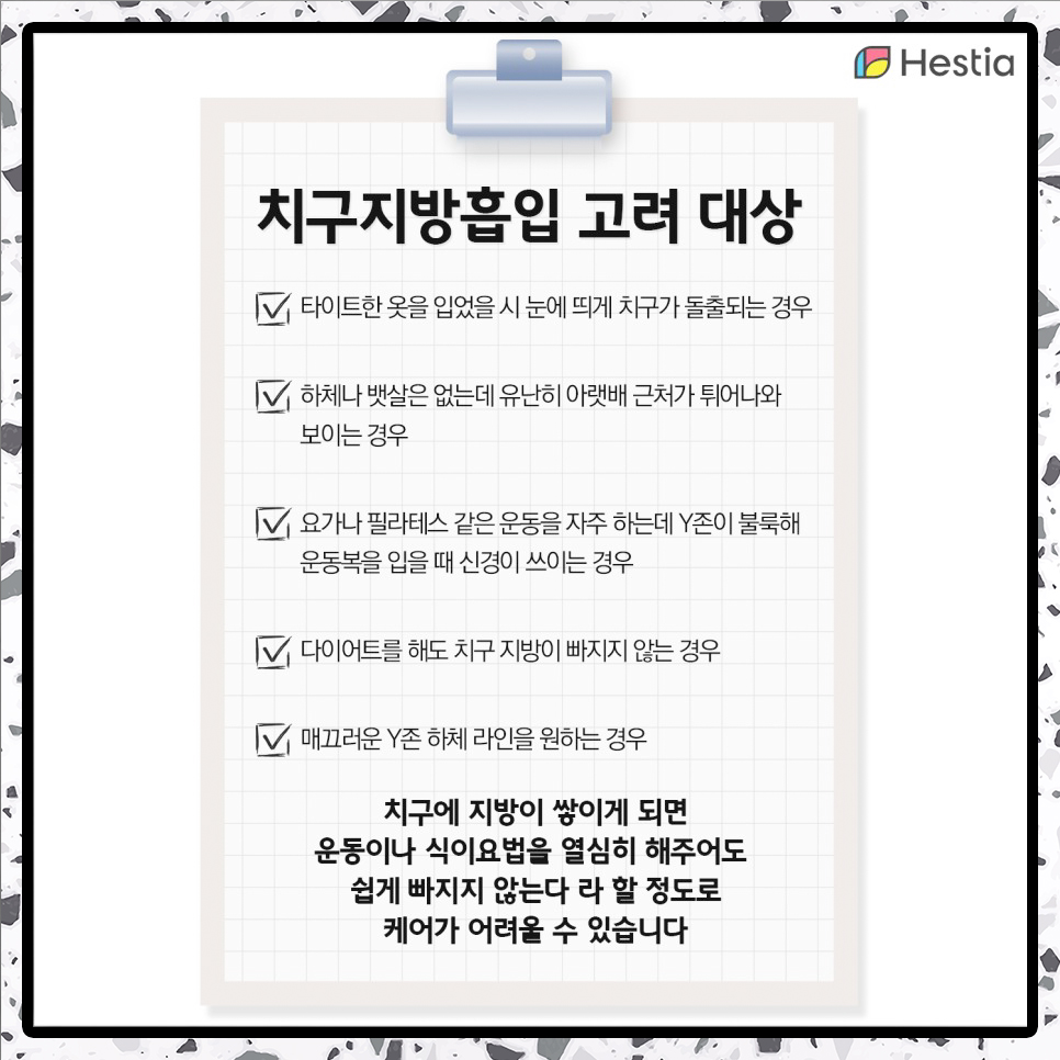치구지방흡입 고려 대상