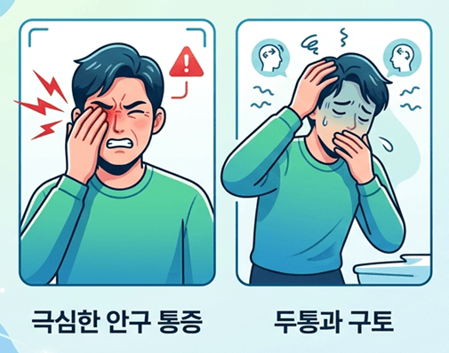 녹내장 원인
