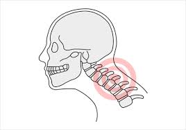 뒷골이 땡기는 증상