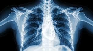 2025 건강검진 대상자 조회 및 신청 방법