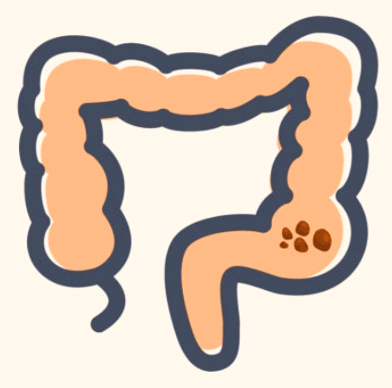 대장내시경 전 먹어도 되는음식