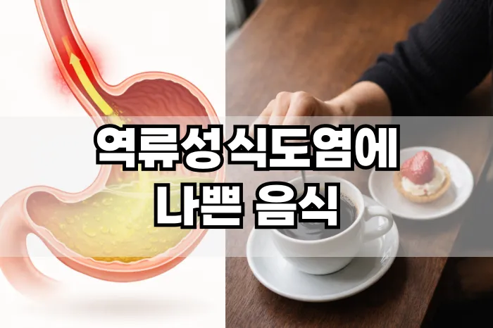 역류성 식도염에 나쁜 음식