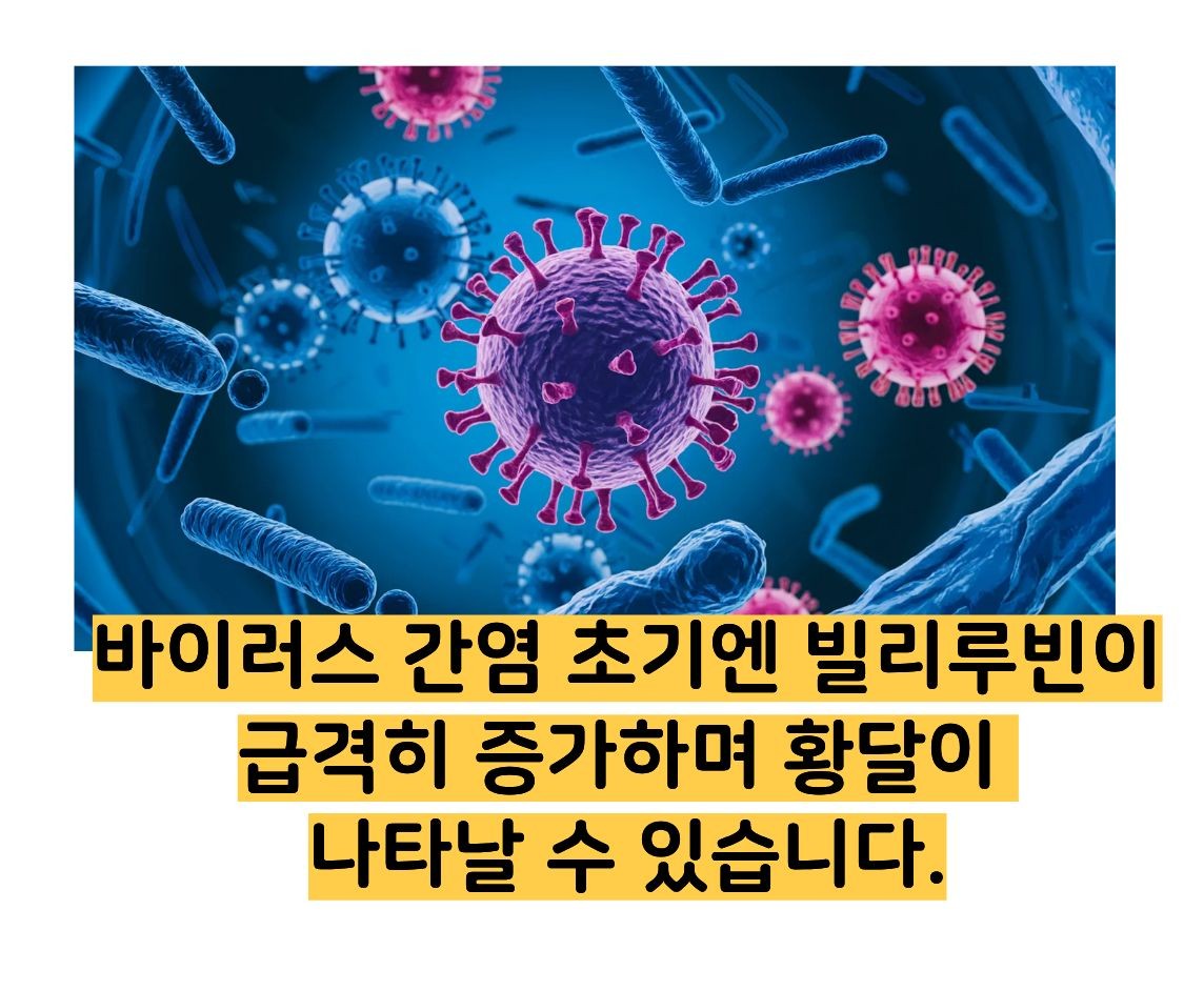 빌리루빈 수치상승 원인