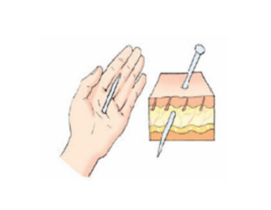 상처의 종류별 특징과 치료법, 이것만 알면 끝!