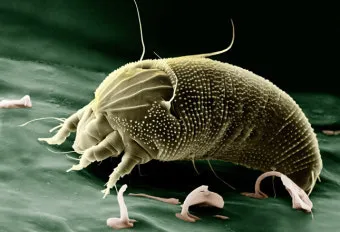 진드기 물린자국 대처법 참진드기 빨간 진드기 증상 확인_3