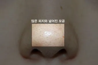 남자 얼굴 피지 제거 화장품 꿀템_10