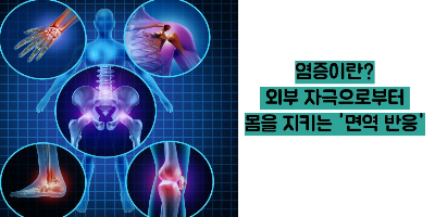 염증에 좋은 음식