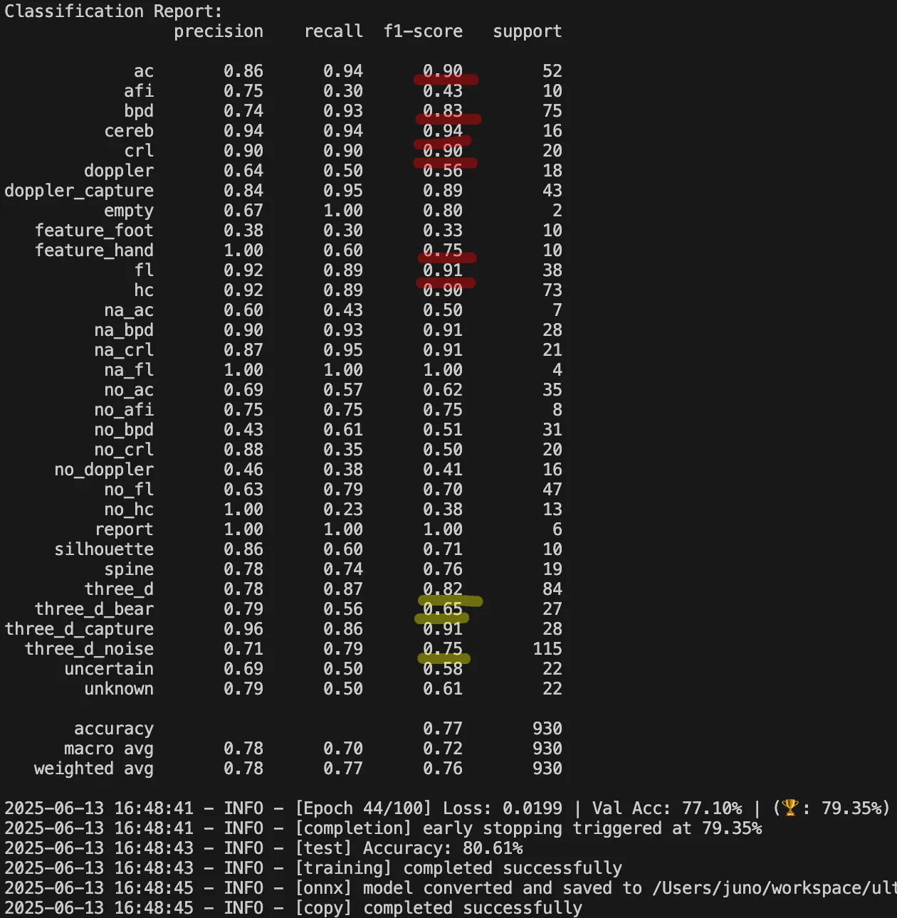 개선 전 테스트 결과 #2
