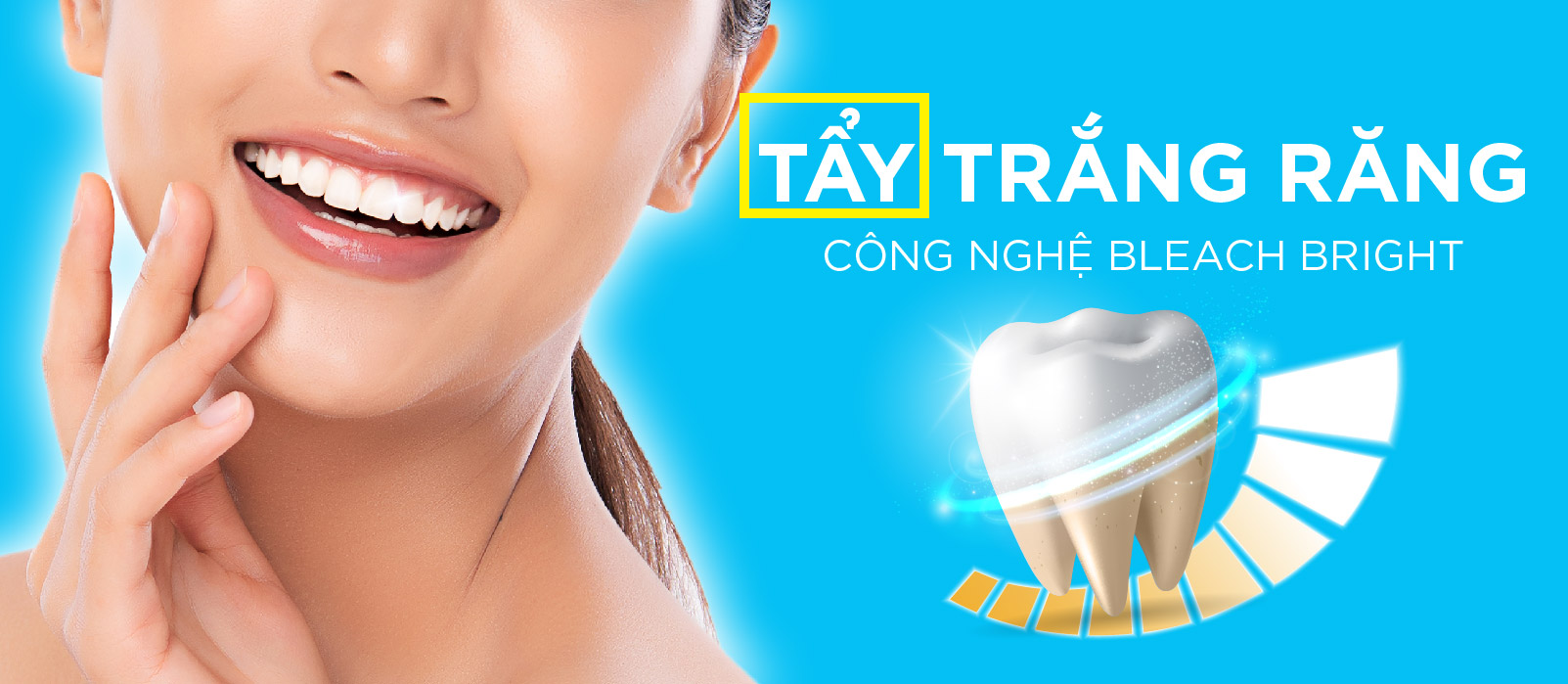 치아미백 광고 배너