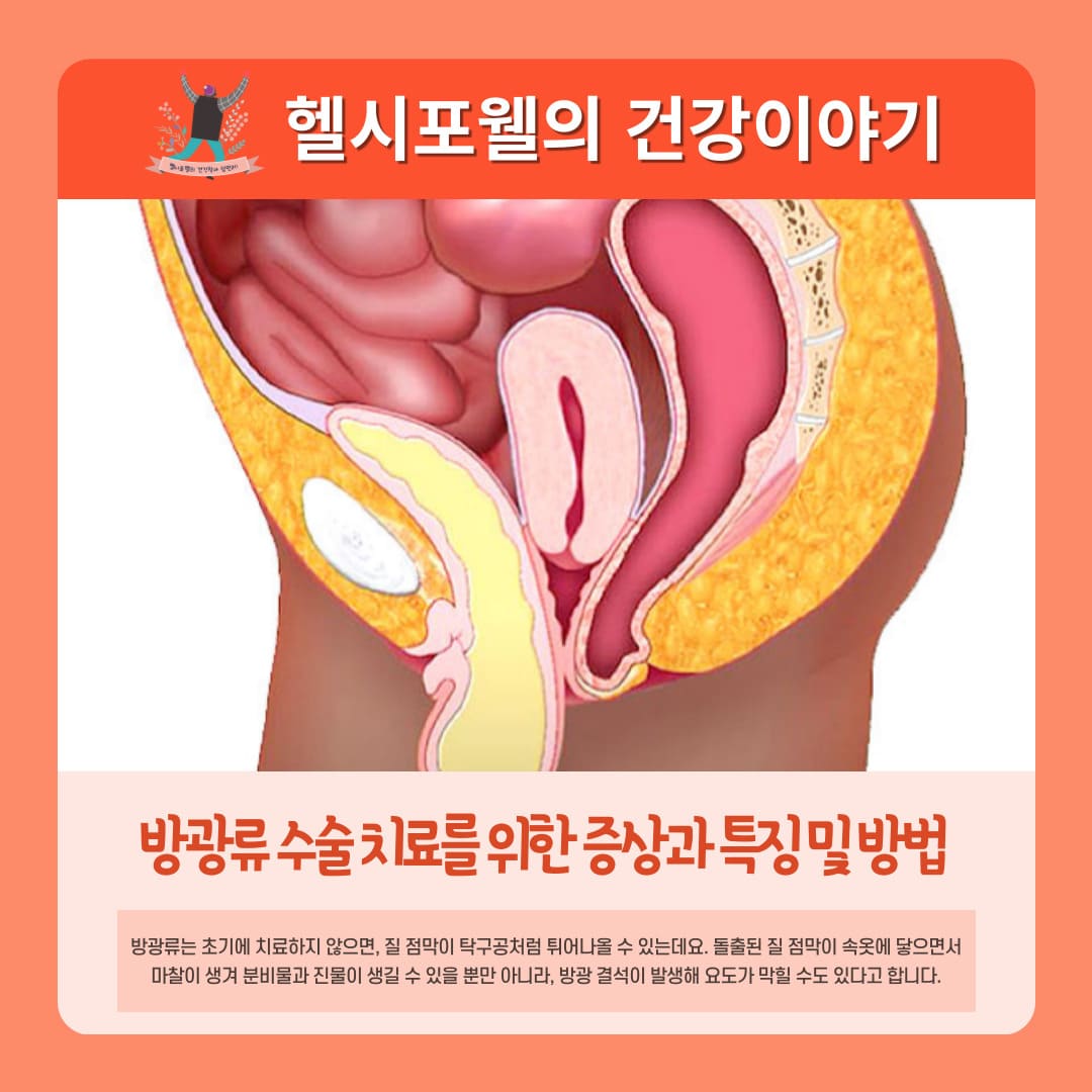 방광류 수술 치료를 위한 증상과 특징 및 방법 알아보기