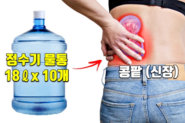 콩팥이 안좋을때 증상,콩팥이 안좋으면 나타나는 증상