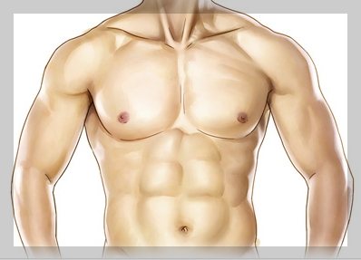 남성여유증 치료 결과