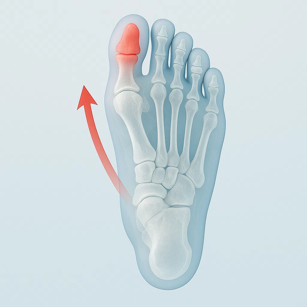 왼쪽 엄지발가락으로 향하는 힘