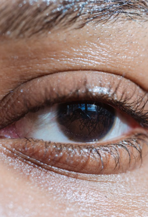 백내장 관련 사진