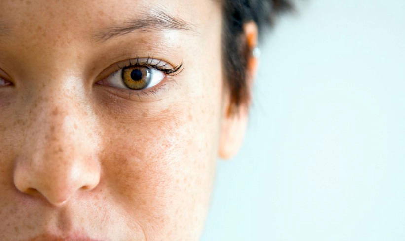 기미 제거에 도움이 되는 음식