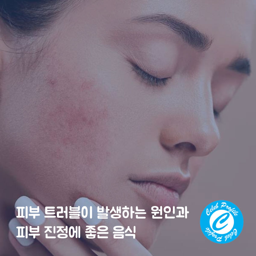 피부트러블원인
