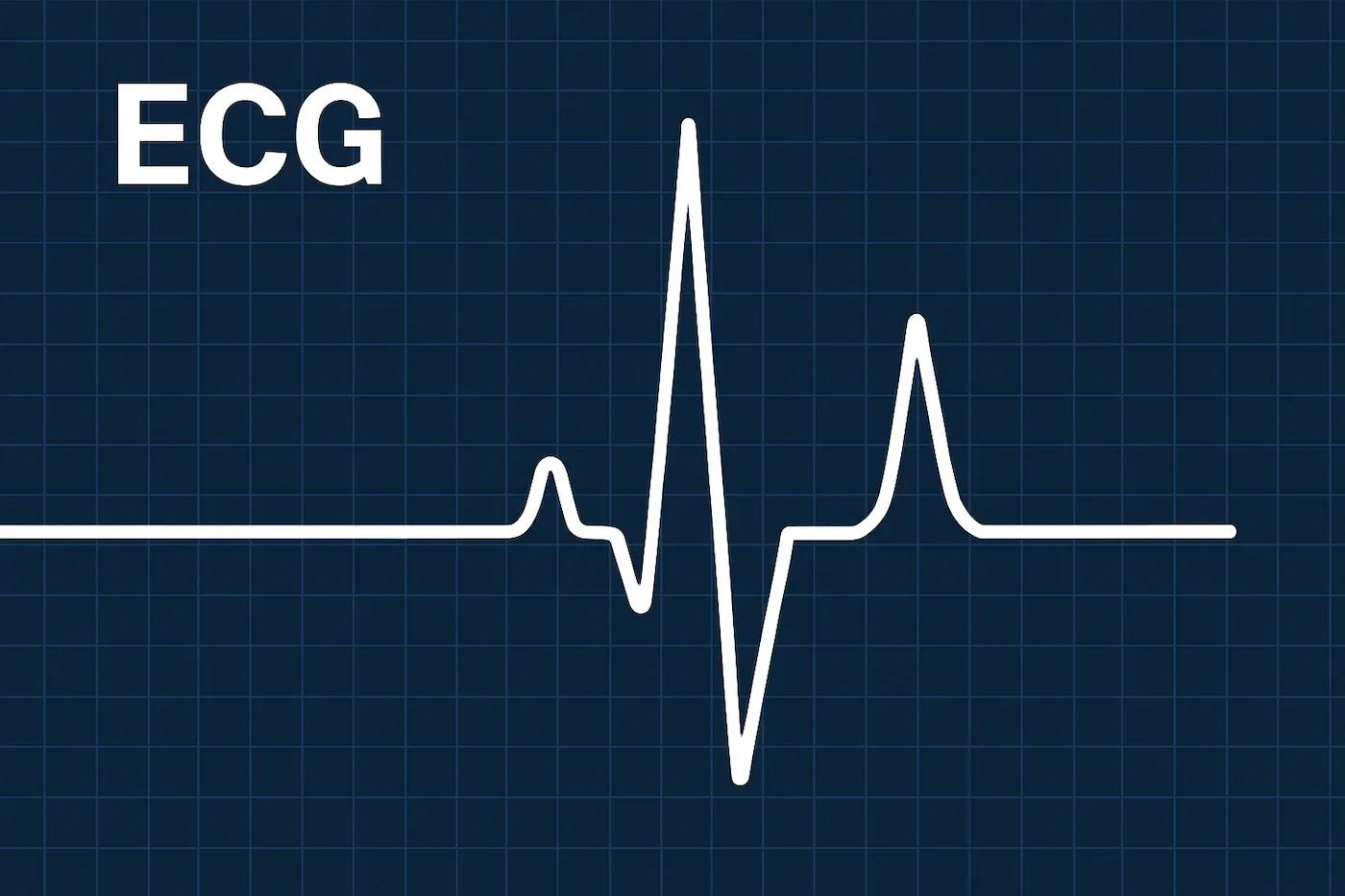 심전도(ECG) 그래프의 연속성 분석을 위한 심박 파형 이미지