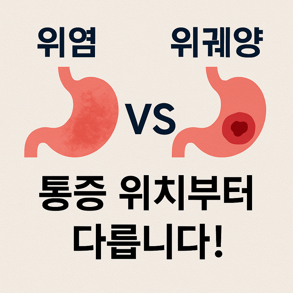 위염 vs 위궤양, 통증 위치부터 다릅니다! 정확히 구분하는 방법