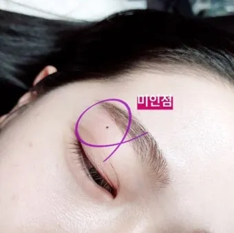 눈과 눈사이 점 관상 의미와 해석_19