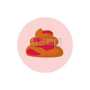 분변검사 방법