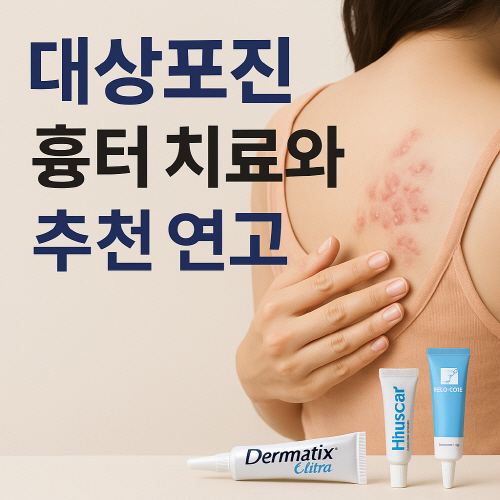 대상포진 흉터 치료와 추천 연고 소개 썸네일, 연고 바르는 여성과 3가지 흉터 연고