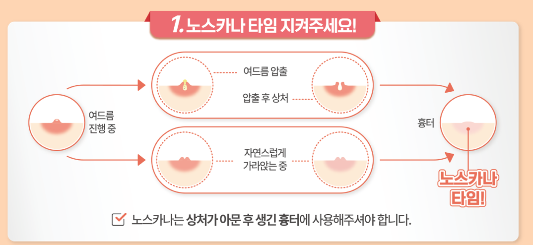 노스카나 사용 방법 아문상처