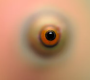 녹내장 초기증상 원인 치료법