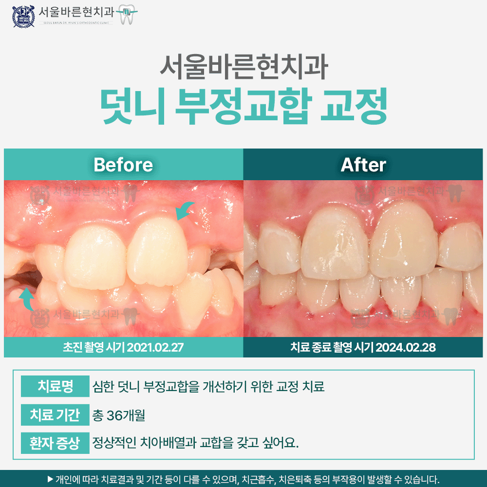 해운대교정치과