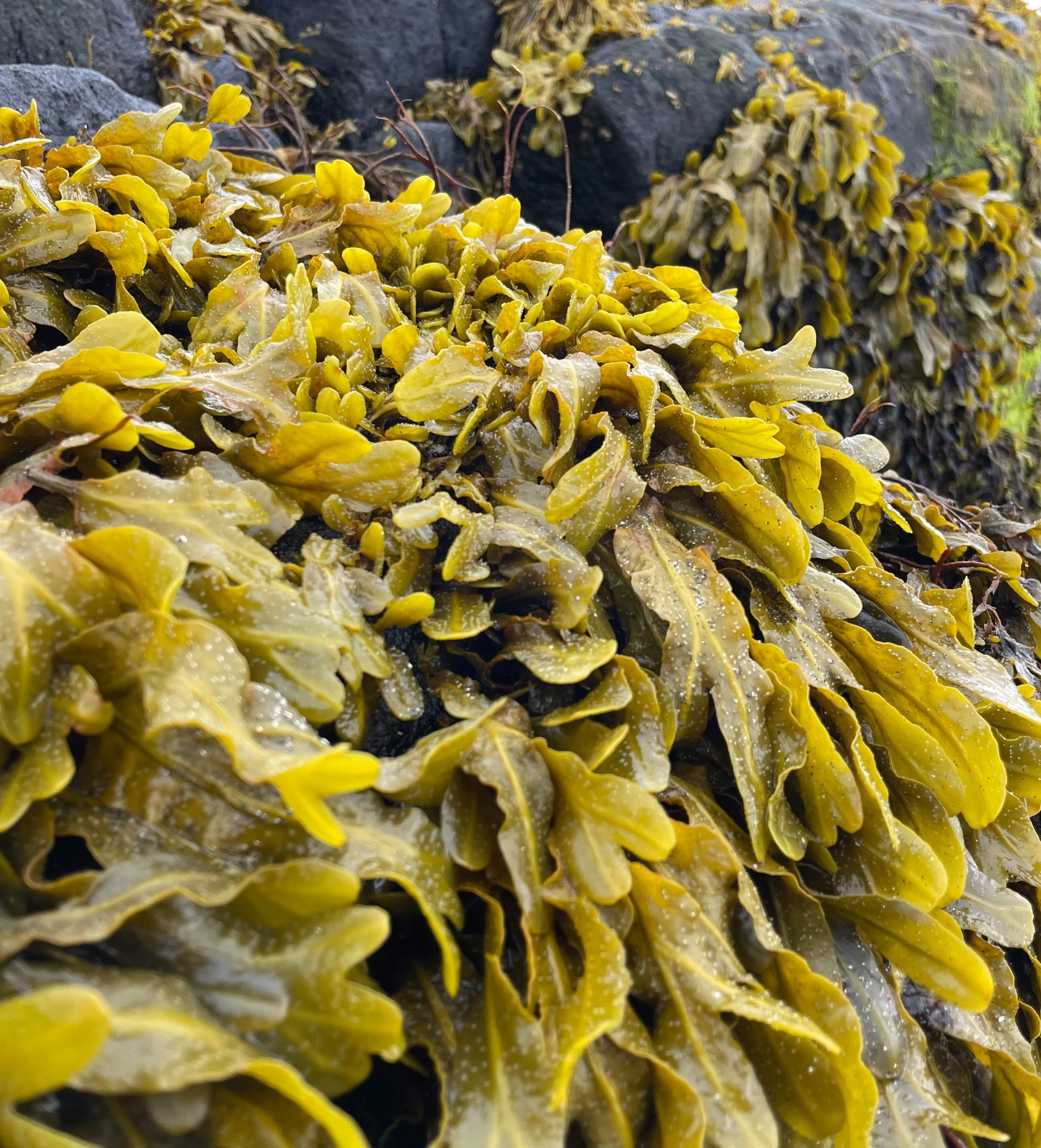 갑상선기능저하증 증상