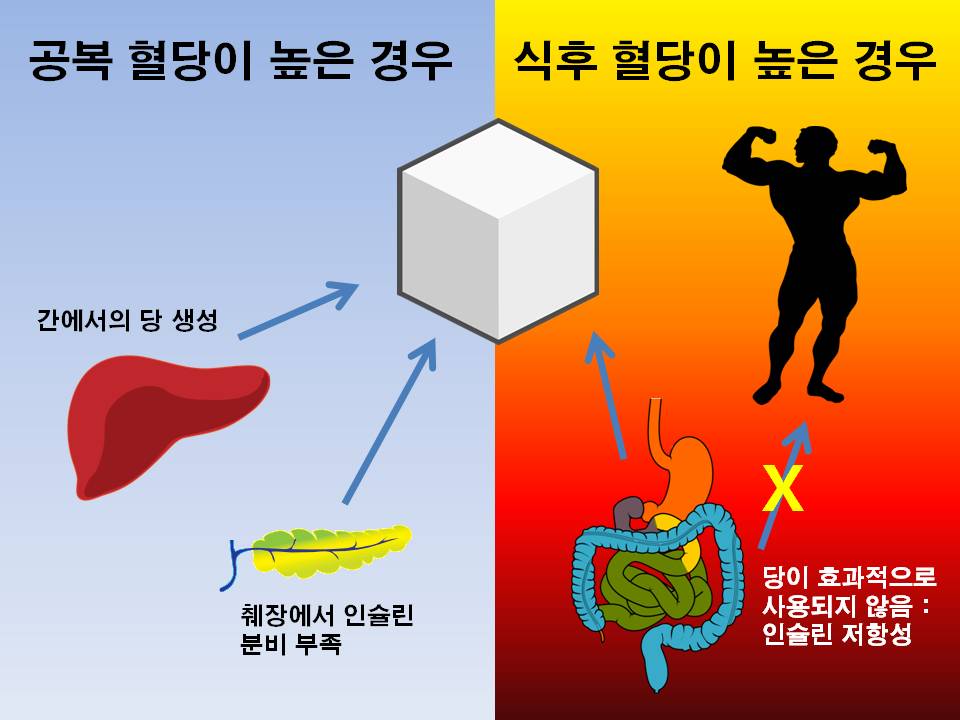 공복혈당수치