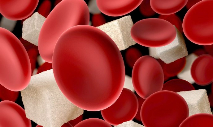 혈당 스파이크 증상