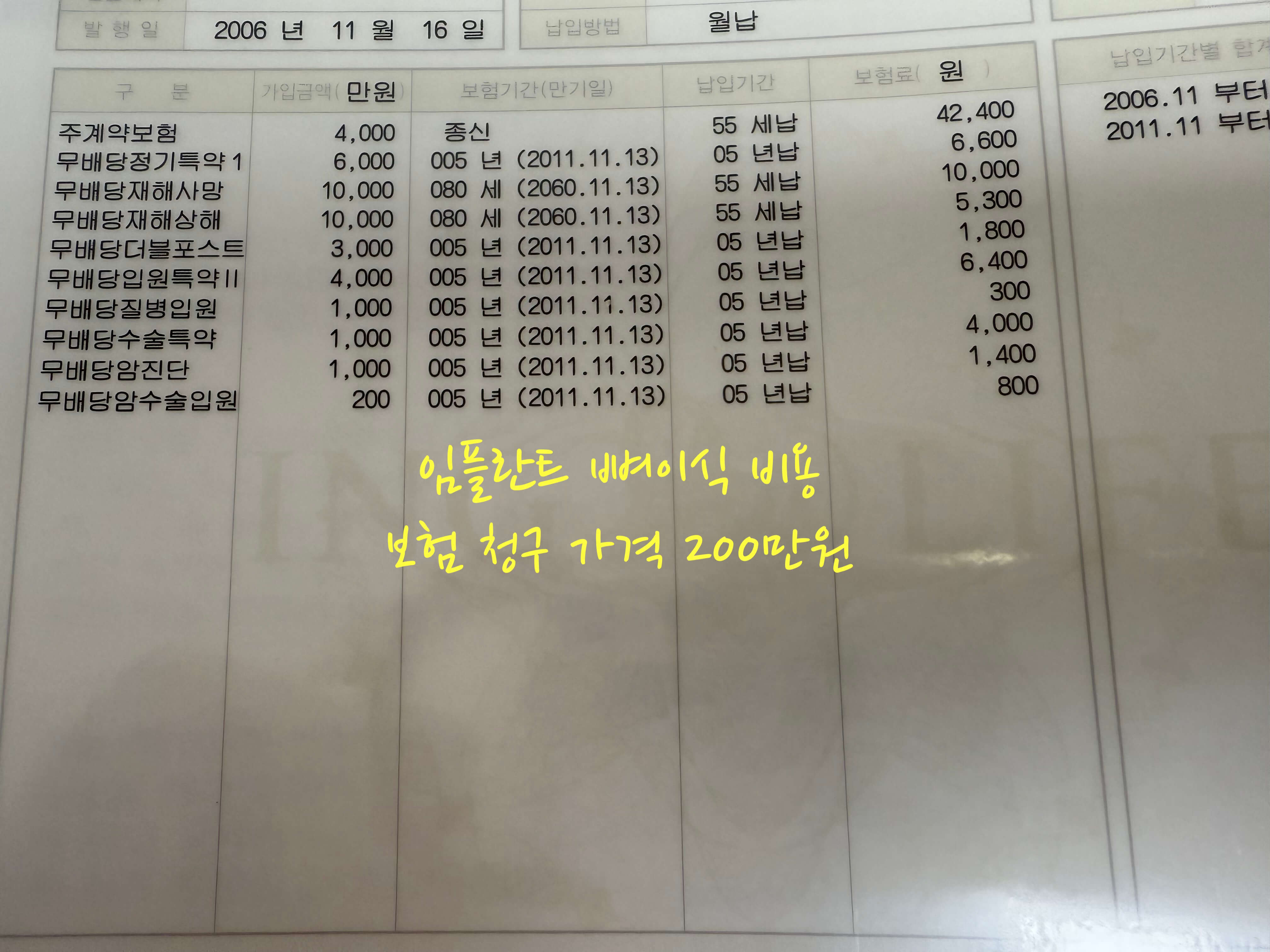 임플란트 뼈이식 비용