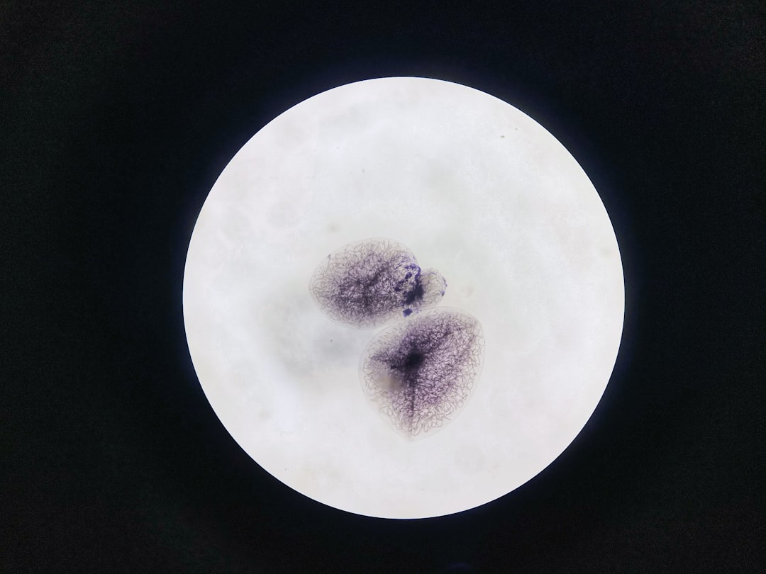 NK cell test