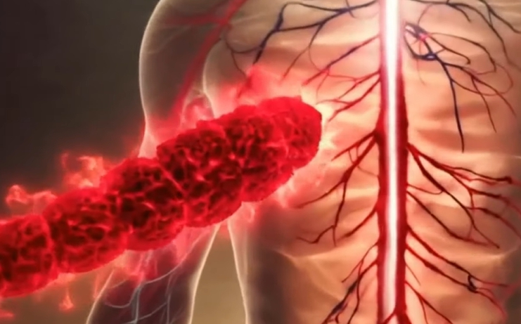 에이즈 초기증상