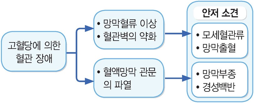 당뇨망막병증