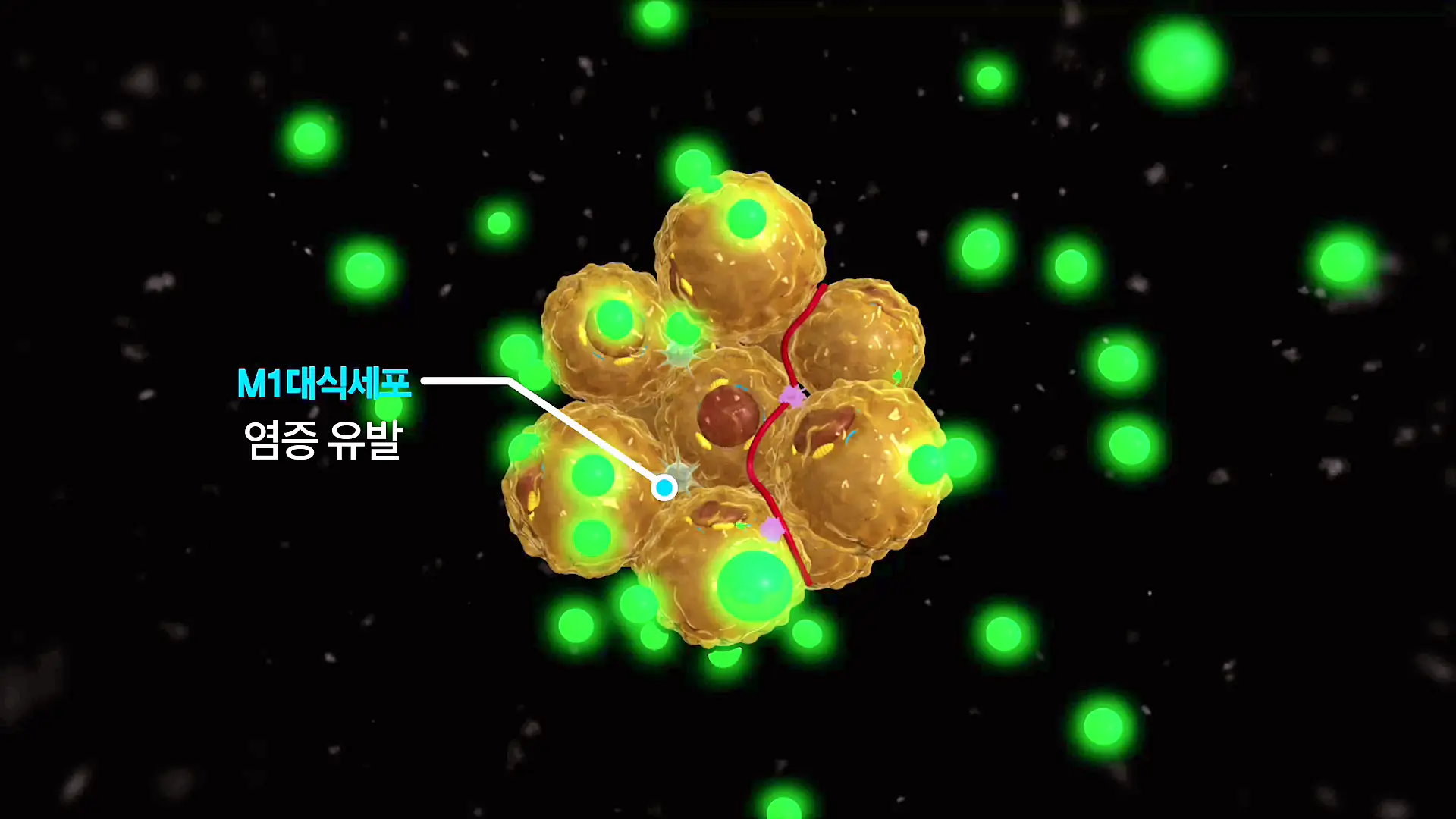 KBS 생로병사의 비밀 827회 최후의 다이어트 고도비만 위절제 수술, 위우회술 수술 차이점과 의료보험 대상 조건