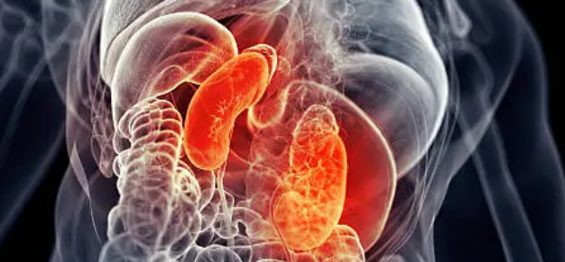 폐암 관련 사진