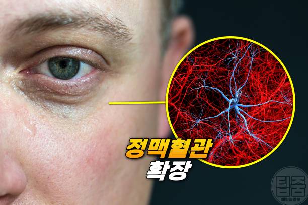 다크서클 원인 아이크림 추천 눈밑처짐 눈밑지방